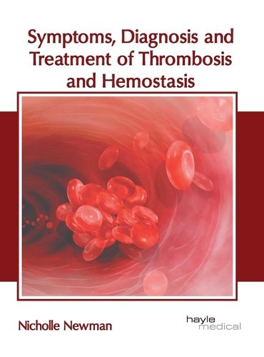 Cover image for Symptoms, Diagnosis and Treatment of Thrombosis and Hemostasis