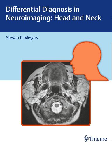 Cover image for Differential Diagnosis in Neuroimaging: Head and Neck