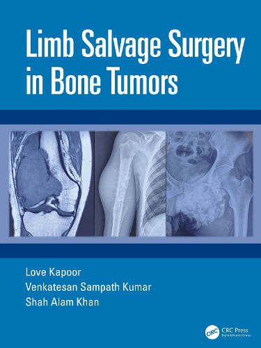 Cover image for Limb Salvage Surgery in Bone Tumors