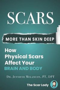 Cover image for Scars: More Than Skin Deep: How Physical Scars Affect Your Body and Brain