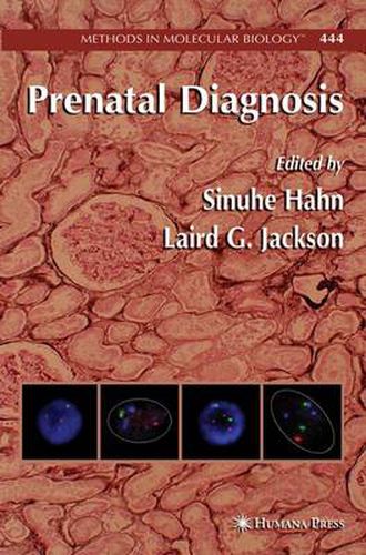 Cover image for Prenatal Diagnosis