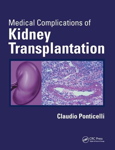 Cover image for Medical Complications of Kidney Transplantation