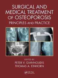 Cover image for Surgical and Medical Treatment of Osteoporosis