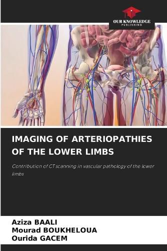 Cover image for Imaging of Arteriopathies of the Lower Limbs