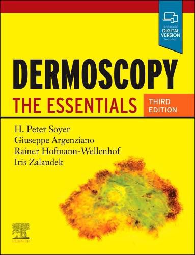 Cover image for Dermoscopy: The Essentials