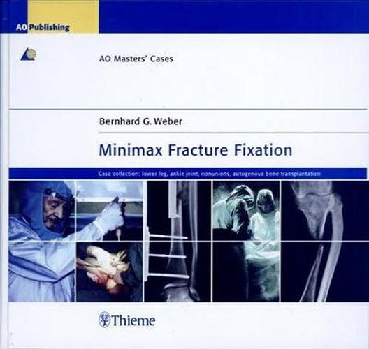 Cover image for Minimax Fracture Fixation: AO Masters' Cases