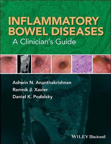 Cover image for Inflammatory Bowel Diseases - A Clinician's Guide