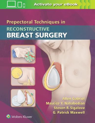 Cover image for Prepectoral Techniques in Reconstructive Breast Surgery