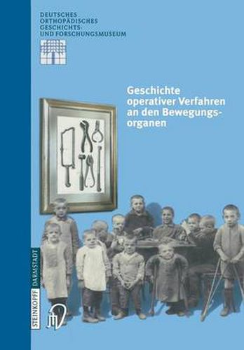 Cover image for Geschichte Operativer Verfahren an Den Bewegungsorganen