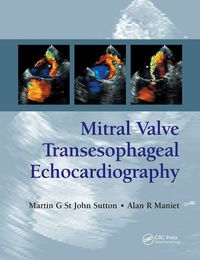 Cover image for Mitral Valve Transesophageal Echocardiography