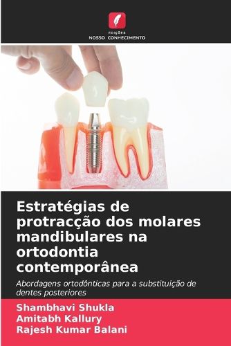 Cover image for Estrategias de protraccao dos molares mandibulares na ortodontia contemporanea