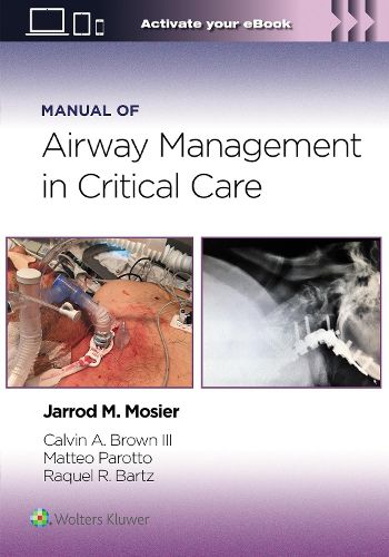 Cover image for Manual of Airway Management in Critical Care: Print + eBook with Multimedia