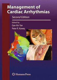 Cover image for Management of Cardiac Arrhythmias