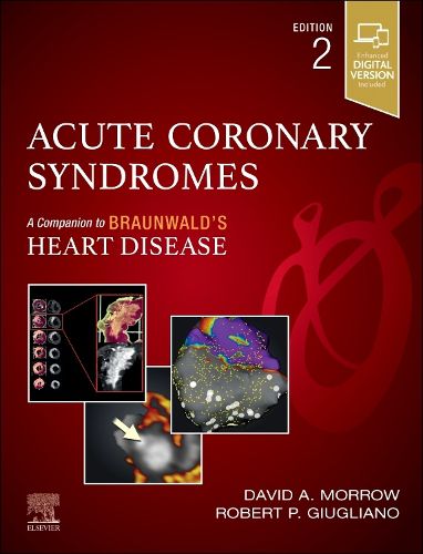 Cover image for Acute Coronary Syndromes