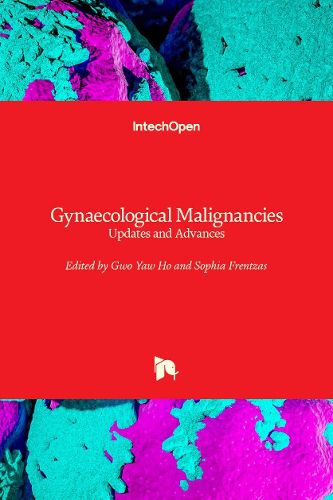 Cover image for Gynaecological Malignancies: Updates and Advances