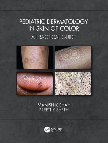 Cover image for Pediatric Dermatology in Skin of Color: A Practical Guide