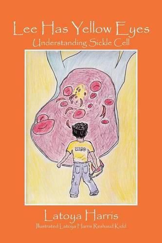 Cover image for Lee Has Yellow Eyes: Understanding Sickle Cell