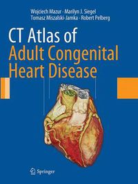 Cover image for CT Atlas of Adult Congenital Heart Disease