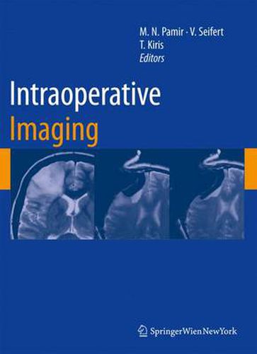 Cover image for Intraoperative Imaging