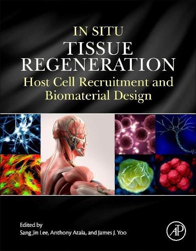 Cover image for In Situ Tissue Regeneration: Host Cell Recruitment and Biomaterial Design