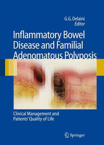 Cover image for Inflammatory Bowel Disease and Familial Adenomatous Polyposis: Clinical Management and Patients' Quality of Life