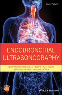 Cover image for Endobronchial Ultrasonography 2e