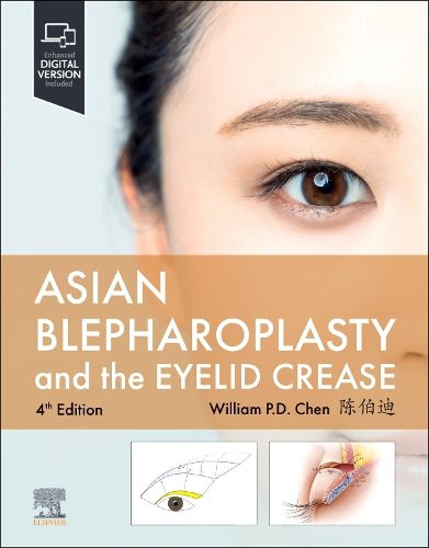 Cover image for Asian Blepharoplasty and the Eyelid Crease