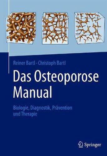 Cover image for Das Osteoporose Manual: Biologie, Diagnostik, Pravention und Therapie