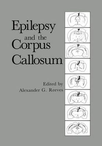 Cover image for Epilepsy and the Corpus Callosum