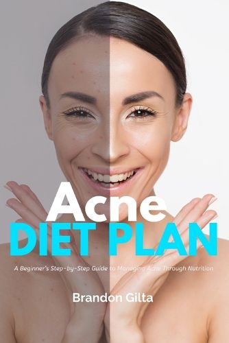 Cover image for Acne Diet Plan