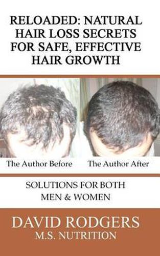 Cover image for Reloaded: Natural Hair Loss Secrets for Safe, Effective Hair Growth