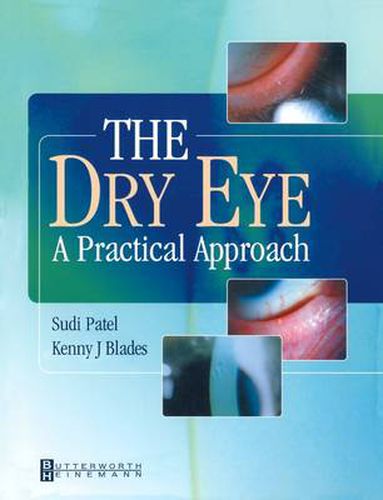 Cover image for The Dry Eye: A Practical Approach