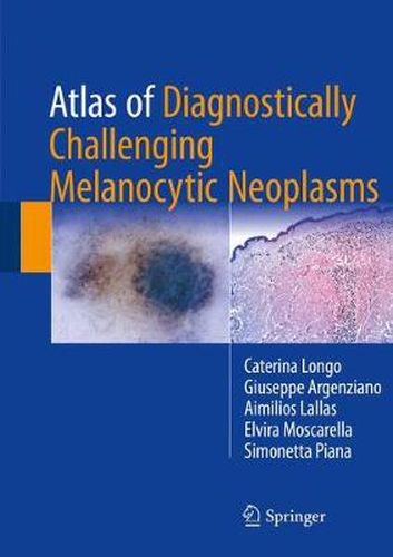 Cover image for Atlas of Diagnostically Challenging Melanocytic Neoplasms