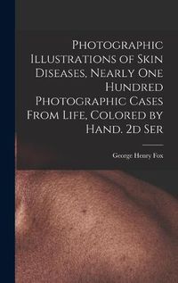 Cover image for Photographic Illustrations of Skin Diseases, Nearly One Hundred Photographic Cases From Life, Colored by Hand. 2d Ser