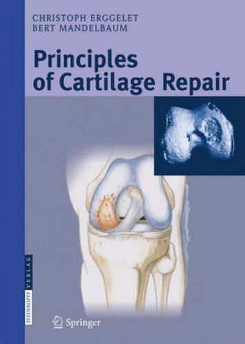 Cover image for Principles of Cartilage Repair