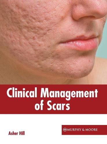 Cover image for Clinical Management of Scars