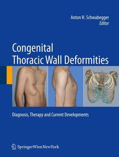 Cover image for Congenital Thoracic Wall Deformities: Diagnosis, Therapy and Current Developments