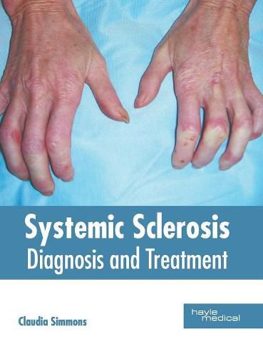 Cover image for Systemic Sclerosis: Diagnosis and Treatment