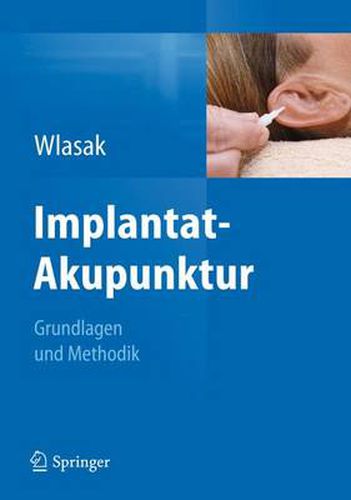 Cover image for Implantat-Akupunktur: Grundlagen und Methodik