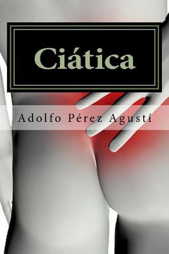 Cover image for Ciatica