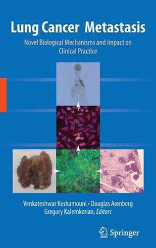 Lung Cancer Metastasis: Novel Biological Mechanisms and Impact on Clinical Practice