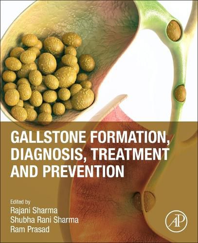 Cover image for Gallstone Formation, Diagnosis, Treatment and Prevention