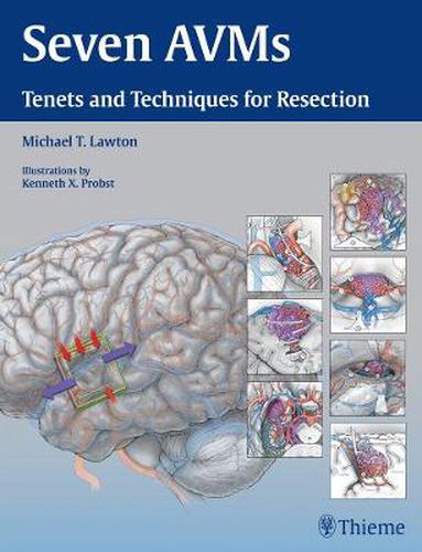 Cover image for Seven AVMs: Tenets and Techniques for Resection