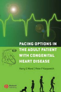 Cover image for Pacing Options in the Adult Patient with Congenital Heart Disease