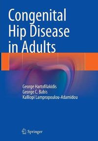 Cover image for Congenital Hip Disease in Adults