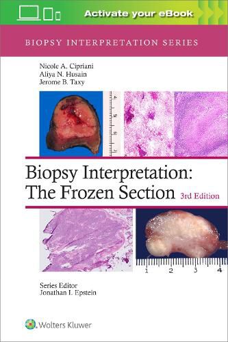 Cover image for Biopsy Interpretation: The Frozen Section