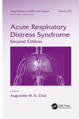 Cover image for Acute Respiratory Distress Syndrome