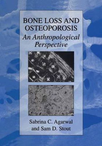 Cover image for Bone Loss and Osteoporosis: An Anthropological Perspective