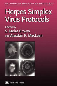 Cover image for Herpes Simplex Virus Protocols