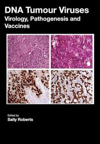 Cover image for DNA Tumour Viruses: Virology, Pathogenesis and Vaccines